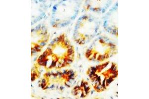 Image no. 1 for anti-Alkaline Phosphatase, Liver/bone/kidney (ALPL) (N-Term) antibody (ABIN1495053) (ALPL anticorps  (N-Term))