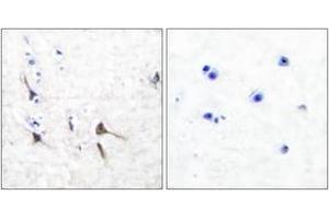 Immunohistochemistry analysis of paraffin-embedded human brain tissue, using Potassium Channel Kv3. (Kv3.2b Potassium Channel anticorps  (AA 589-638))