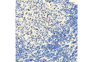 Immunohistochemistry of paraffin-embedded rat spleen using HD antibody (ABIN7267708) at dilution of 1:100 (40x lens). (HDAC2 anticorps)