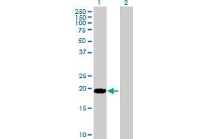 Western Blot analysis of LTA expression in transfected 293T cell line by LTA MaxPab polyclonal antibody.