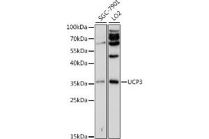 Western blot analysis of extracts of various cell lines, using UCP3 antibody (ABIN3022085, ABIN3022086, ABIN3022087, ABIN1513663 and ABIN6218600) at 1:500 dilution. (UCP3 anticorps  (AA 1-110))