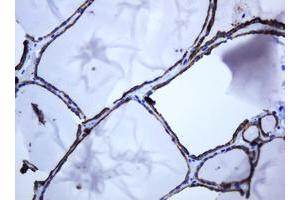 Image no. 4 for anti-ATP-Binding Cassette, Sub-Family B (MDR/TAP), Member 1 (ABCB1) (AA 995-1280) antibody (ABIN1491724)