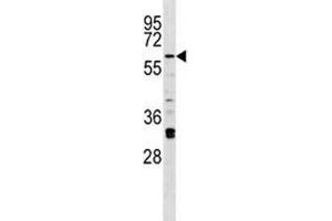 Irak2 antibody western blot analysis in A375 lysate.