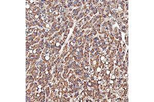 IHC analysis of SCO1 using anti-SCO1 antibody (ABIN7600609). (SCO1 anticorps  (AA 21-301))