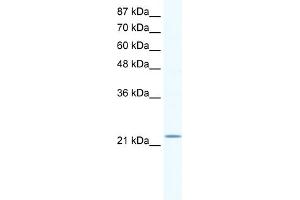 WB Suggested Anti-RGS10 Antibody   Titration: 1. (RGS10 anticorps  (Middle Region))