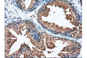 Immunohistochemical staining of paraffin-embedded Human liver tissue using anti-PANK2 mouse monoclonal antibody. (PANK2 anticorps)