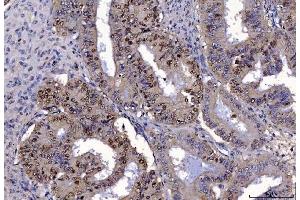 IHC analysis of FEN1 using anti-FEN1 antibody (ABIN7601618). (FEN1 anticorps  (AA 4-300))
