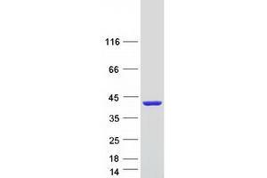 Validation with Western Blot