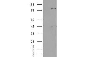 Western Blotting (WB) image for anti-Pyruvate Carboxylase (PC) (Internal Region) antibody (ABIN2466170) (PC anticorps  (Internal Region))