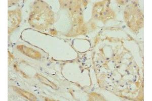 Immunohistochemistry of paraffin-embedded human kidney tissue using ABIN7153251 at dilution of 1:100 (FXYD5 anticorps  (AA 22-145))
