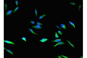 Immunofluorescent analysis of Hela cells using ABIN7148885 at dilution of 1:100 and Alexa Fluor 488-congugated AffiniPure Goat Anti-Rabbit IgG(H+L)