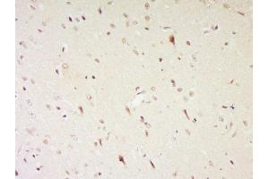 Paraformaldehyde-fixed, paraffin embedded rat brain, Antigen retrieval by boiling in sodium citrate buffer (pH6) for 15min, Block endogenous peroxidase by 3% hydrogen peroxide for 30 minutes, Blocking buffer (normal goat serum) at 37°C for 20min, Antibody incubation with NGB/neuroglobin Polyclonal Antibody, Unconjugated  at 1:500 overnight at 4°C, followed by a conjugated secondary and DAB staining