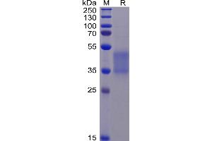 Human FA Protein (F176V), His Tag on SDS-PAGE under reducing condition.