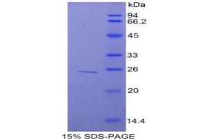 SDS-PAGE analysis of Rat TNIP2 Protein. (TNIP2 Protéine)