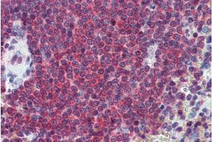 ABIN571033 (2. (CA1 anticorps  (Internal Region))