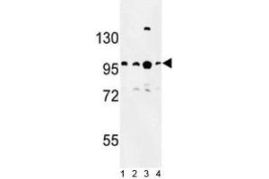 Western blot analysis of BCL11A antibody and 1) Jurkat, 2) Ramos, 3) 293 and 4)NCI-H460 lysate.