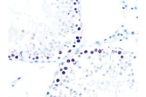 Immunohistochemistry of paraffin-embedded rat testis using K/H Rabbit mAb (ABIN7267702) at dilution of 1:100 (40x lens).