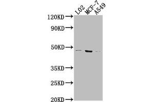 Western Blot Positive WB detected in: LO2 whole cell lysate, MCF-7 whole cell lysate, A549 whole cell lysate All lanes: USP17L6P antibody at 1:2000 Secondary Goat polyclonal to rabbit IgG at 1/50000 dilution Predicted band size: 45 kDa Observed band size: 45 kDa (USP17L6P anticorps  (C-Term))