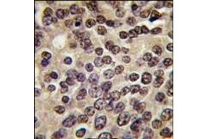 Image no. 2 for anti-Protein Kinase N3 (PKN3) (C-Term) antibody (ABIN360331)