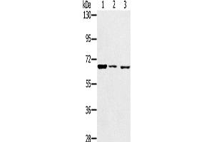 Western Blotting (WB) image for anti-Insulin-Like Growth Factor 2 mRNA Binding Protein 3 (IGF2BP3) antibody (ABIN2428265) (IGF2BP3 anticorps)
