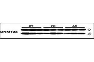 Lysates from mice thymus tissue after radiation were subjected to WB using antibody against DNMT3a. (DNMT3A anticorps  (AA 457-486))