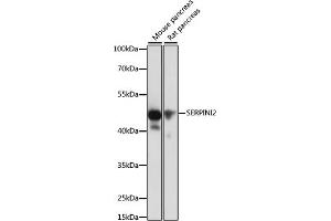 Western blot analysis of extracts of various cell lines, using SERPINI2 antibody (ABIN6131321, ABIN6147617, ABIN6147618 and ABIN6215429) at 1:1000 dilution.