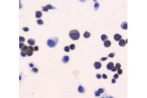 IHC analysis of Thioredoxin TRX using anti-Thioredoxin TRX antibody (ABIN6719381). (TXN anticorps  (AA 2-105))