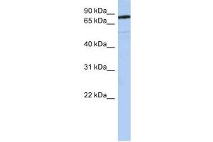WB Suggested Anti-SEMA4B Antibody Titration:  0.