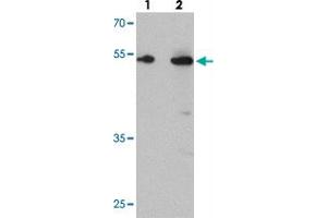 Western blot analysis of TMEM135 in rat liver tissue with TMEM135 polyclonal antibody  at (lane 1) 1 and (lane 2) 2 ug/mL. (TMEM135 anticorps  (C-Term))
