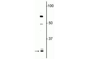 Western blot of neonatal rat brain lysate showing specific immunolabeling of the ~ 27 kDa Olig1 protein. (OLIG1 anticorps)