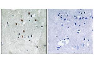Immunohistochemistry analysis of paraffin-embedded human brain tissue using SRF (Phospho-Ser77) antibody. (SRF anticorps  (pSer77))