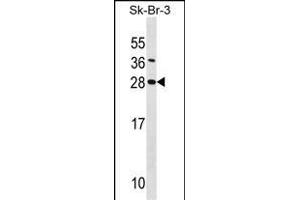 SDC4 Antibody (Center) (ABIN1538722 and ABIN2848544) western blot analysis in SK-BR-3 cell line lysates (35 μg/lane). (SDC4 anticorps  (AA 98-127))