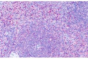 Anti-GPR63 antibody IHC staining of human spleen.