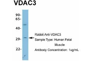 Host: Rabbit Target Name: VDAC3 Sample Type: Human Fetal Muscle Antibody Dilution: 1. (VDAC3 anticorps  (N-Term))