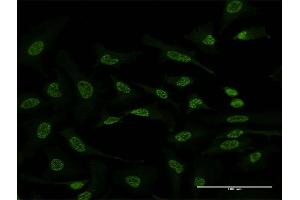 Immunofluorescence of monoclonal antibody to ATF2 on HeLa cell.
