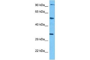 Host:  Mouse  Target Name:  TCF7L2  Sample Tissue:  Mouse Kidney  Antibody Dilution:  1ug/ml (TCF7L2 anticorps  (N-Term))