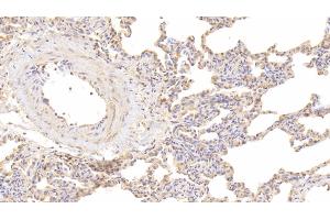 Detection of IL9 in Human Lung Tissue using Polyclonal Antibody to Interleukin 9 (IL9) (IL-9 anticorps  (AA 19-144))