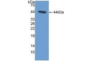 Detection of Recombinant NT-ProANP, Rat using Polyclonal Antibody to N-Terminal Pro-Atrial Natriuretic Peptide (NT-ProANP) (PRO-ANP anticorps  (AA 25-122))