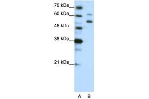 WB Suggested Anti-WDR4 Antibody Titration:  1. (WDR4 anticorps  (C-Term))