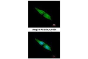 ICC/IF Image Immunofluorescence analysis of paraformaldehyde-fixed HeLa, using MAPK4, antibody at 1:200 dilution.