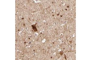 Immunohistochemical staining of human cerebral cortex with CLOCK polyclonal antibody  shows moderate nuclear positivity in neuronal cells. (CLOCK anticorps)