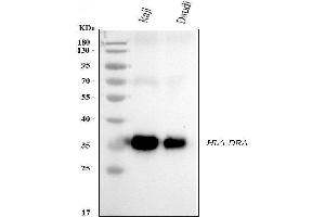 Western blot analysis of HLA-DRA using anti-HLA-DRA antibody (ABIN7600949).