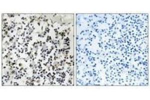 Immunohistochemistry analysis of paraffin-embedded human lymph node tissue using CLIC4 antibody.