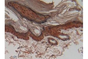 DAB staining on IHC-P; Samples: Rat Skin Tissue (CSTA anticorps  (AA 1-103))