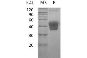 Western Blotting (WB) image for Colony Stimulating Factor 1 (Macrophage) (CSF1) protein (His tag) (ABIN7320617) (M-CSF/CSF1 Protein (His tag))