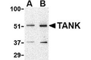 Western blot analysis of TANK in Daudi cell lysate with this product at (A) 0. (TANK anticorps  (N-Term))