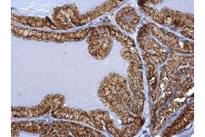 IHC-P Image ERAB antibody detects ERAB protein at mitochondria on mouse prostate by immunohistochemical analysis.