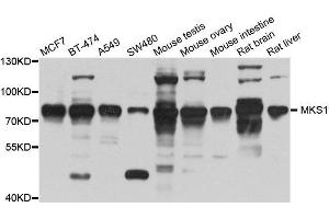 Western blot analysis of extracts of various cell lines, using MKS1 antibody. (MKS1 anticorps  (AA 150-300))