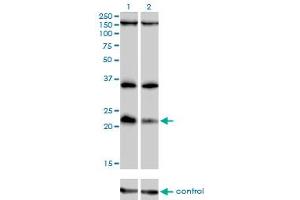 Western blot analysis of DUSP22 over-expressed 293 cell line, cotransfected with DUSP22 Validated Chimera RNAi (Lane 2) or non-transfected control (Lane 1). (DUSP22 anticorps  (AA 112-184))