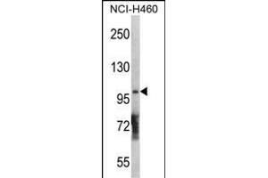 DGKQ Antibody  (ABIN392717 and ABIN2842188) western blot analysis in NCI- cell line lysates (35 μg/lane). (DGKQ anticorps  (C-Term))